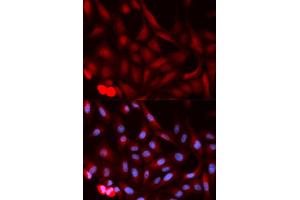 Immunofluorescence (IF) image for anti-Proteasome (Prosome, Macropain) Activator Subunit 1 (PA28 Alpha) (PSME1) antibody (ABIN1876546) (PSME1 抗体)