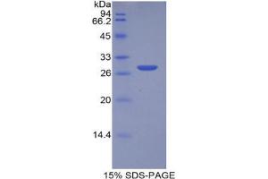 SDS-PAGE analysis of Human MPST Protein. (MPST 蛋白)