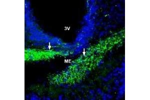 Immunohistochemistry (IHC) image for anti-Solute Carrier Family 39 (Zinc Transporter), Member 6 (SLC39A6) (AA 251-264), (Extracellular) antibody (ABIN7043725)