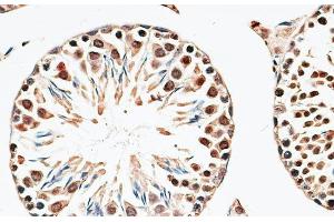 Immunohistochemistry of paraffin-embedded Mouse testis using CBX6 Polyclonal Antibody at dilution of 1:100 (40x lens). (CBX6 抗体)