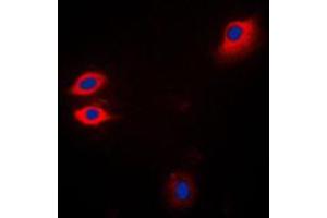 Immunofluorescent analysis of JAK1 staining in Jurkat cells. (JAK1 抗体  (C-Term))