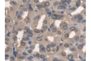 Immunohistochemistry (IHC) image for anti-Pyridoxamine 5'-Phosphate Oxidase (PNPO) (AA 1-261) antibody (ABIN7444253)