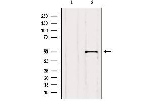 Western blot analysis of extracts from Rat brain, using GFAP Antibody.