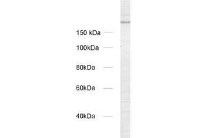 dilution: 1 : 1000, sample: crude synaptosomal fraction of rat brain (P2) (UNC13A/Munc13-1 抗体  (AA 3-317))