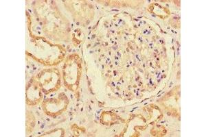 Immunohistochemistry of paraffin-embedded human kidney tissue using ABIN7151063 at dilution of 1:100 (MIB1 抗体  (AA 5-332))