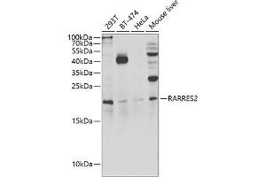 Western blot analysis of extracts of various cell lines, using R antibody (ABIN6131585, ABIN6146704, ABIN6146705 and ABIN6222716) at 1:1000 dilution. (Chemerin 抗体  (AA 17-163))