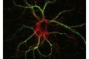 Indirect immunostaining of PFA fixed rat hippocampus neurons with anti-M6a glycoprotein (dilution 1 : 500; red) and mouse anti-MAP 2 (cat. (GPM6A 抗体)