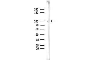 Western blot analysis of lysates from Rat brain, using FUK Antibody at 1/1000 dilution.