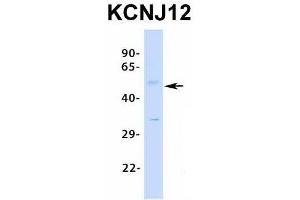 Western Blotting (WB) image for anti-Potassium Inwardly-Rectifying Channel, Subfamily J, Member 12 (KCNJ12) (Middle Region) antibody (ABIN2776235)