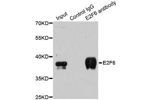 Immunoprecipitation analysis of 200ug extracts of MCF-7 cells using 3ug E2F6 antibody. (E2F6 抗体)