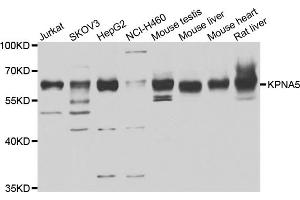 Western blot analysis of extracts of various cell lines, using KPNA5 antibody (ABIN4904175) at 1:1000 dilution. (KPNA5 抗体)