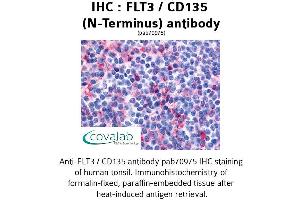 Image no. 1 for anti-Fms-Related tyrosine Kinase 3 (FLT3) (N-Term) antibody (ABIN1734381) (FLT3 抗体  (N-Term))
