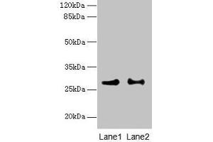 Western blot All lanes: HACD2 antibody at 4 μg/mL Lane 1: MCF-7 whole cell lysate Lane 2: LO2 whole cell lysate Secondary Goat polyclonal to rabbit IgG at 1/10000 dilution Predicted band size: 29 kDa Observed band size: 29 kDa
