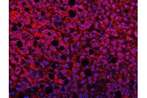 IF analysis of TMPRSS13 using anti-TMPRSS13 antibody (ABIN7599797).