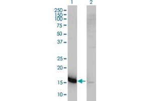 Western Blot analysis of CMTM5 expression in transfected 293T cell line by CKLFSF5 monoclonal antibody (M01), clone 2G1-6B10. (CMTM5 抗体  (AA 1-156))