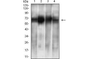Western Blotting (WB) image for anti-Albumin (ALB) (AA 410-609) antibody (ABIN7193633)