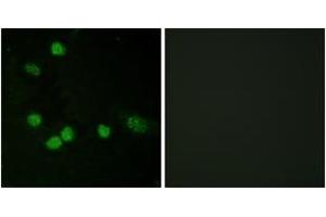 Immunofluorescence analysis of HeLa cells, using C-RAF (Ab-621) Antibody. (RAF1 抗体  (AA 591-640))