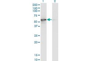 Western Blot analysis of STK25 expression in transfected 293T cell line by STK25 monoclonal antibody (M02), clone 4B10. (STK25 抗体  (AA 321-426))