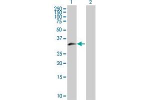 Western Blot analysis of ZNF215 expression in transfected 293T cell line by ZNF215 MaxPab polyclonal antibody. (ZNF215 抗体  (AA 1-304))