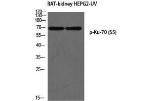Western Blot (WB) analysis of Rat Kidney HepG2-UV using p-Ku-70 (S5) antibody. (XRCC6 抗体  (pSer5))