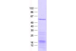 Validation with Western Blot (MAPKAP Kinase 5 Protein (His tag))