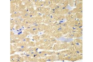 Immunohistochemistry of paraffin-embedded Mouse heart using HAX1 Polyclonal Antibody at dilution of 1:100 (40x lens). (HAX1 抗体)