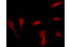 ABIN6267298 staining HeLa by IF/ICC. (APP 抗体  (pThr668))