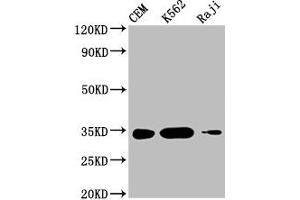 Western Blot Positive WB detected in: CEM whole cell lysate, K562 whole cell lysate, Raji whole cell lysate All lanes: CTLA4 antibody at 1:1000 Secondary Goat polyclonal to mouse IgG at 1/50000 dilution Predicted band size: 25, 7, 9, 20 KDa Observed band size: 34 KDa Exposure time:5 min (CTLA4 抗体  (AA 37-162))