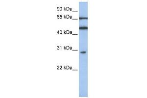 IFIT5 antibody used at 1 ug/ml to detect target protein. (IFIT5 抗体  (N-Term))