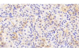 Detection of CHRNa4 in Human Kidney Tissue using Polyclonal Antibody to Cholinergic Receptor, Nicotinic, Alpha 4 (CHRNa4) (CHRNA4 抗体  (AA 49-242))