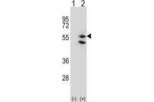 Western blot analysis of TUFM (arrow) using rabbit polyclonal TUFM Antibody (C-term) . (TUFM 抗体  (C-Term))