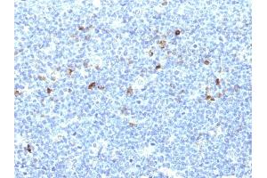 Formalin-fixed, paraffin-embedded human Tonsil stained with MHC I Monoclonal Antibody (CATA-1). (HLA-A 抗体)