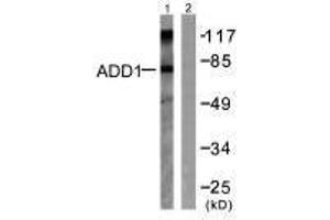 Western blot analysis of extracts from Hela cells treated with Forskolin (40nM, 30 min), using ADD1 (Ab-726) antibody.
