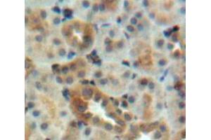 IHC-P analysis of kidney tissue, with DAB staining. (EEA1 抗体  (AA 1232-1348))
