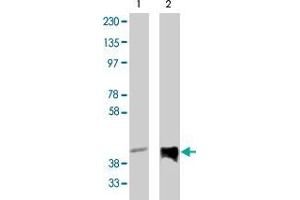 Western blot analysis using PPAP2C polyclonal antibody  on vector-controlled HEK293 cells (lane 1) and HEK293 cells overexpressing PPAP2C protein (lane 2) at 1 ug/mL . (PPAP2C 抗体)