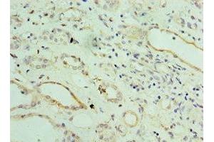 Immunohistochemistry of paraffin-embedded human kidney tissue using ABIN7143802 at dilution of 1:100 (ST8SIA2 抗体  (AA 24-160))
