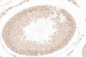 Immunohistochemistry analysis of paraffin-embedded rat testis using,NCKAP1 (ABIN7074784) at dilution of 1: 8000 (NCKAP1 抗体)