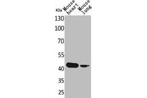 Western Blot analysis of mouse heart mouse lung cells using Actin-α cardiac muscle Polyclonal Antibody (ACTC1 抗体  (N-Term))