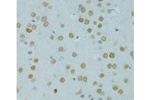 Immunohistochemistry of paraffin-embedded Rat brain using MUS81 Polyclonal Antibody at dilution of 1:100 (40x lens). (MUS81 抗体)