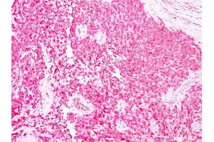 Immunohistochemistry (IHC) image for anti-S100 Calcium Binding Protein B (S100B) antibody (ABIN6940555)