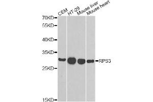 Western blot analysis of extracts of various cell lines, using RPS3 antibody (ABIN6290898) at 1:1000 dilution. (RPS3 抗体)