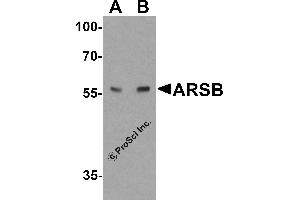 Western Blotting (WB) image for anti-Arylsulfatase B (ARSB) (C-Term) antibody (ABIN2457880) (Arylsulfatase B 抗体  (C-Term))