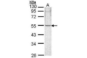WB Image Sample (30 ug of whole cell lysate) A: A431 , 10% SDS PAGE antibody diluted at 1:1000 (ARHGAP1 抗体)