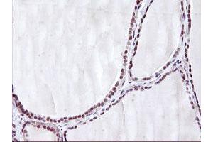 Immunohistochemical staining of paraffin-embedded Human thyroid tissue using anti-HES1 mouse monoclonal antibody. (HES1 抗体)