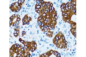 Immunohistochemistry (Paraffin-embedded Sections) (IHC (p)) image for anti-Cathepsin E (CTSE) antibody (ABIN7010198)