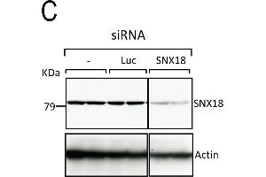 SNX9 depletion phenocopies CHC depletion during mitosis. (SNX18 抗体  (C-Term))