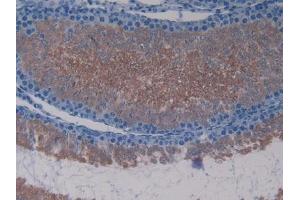 DAB staining on IHC-P; Samples: Rat Testis Tissue (Lactate Dehydrogenase C 抗体  (AA 1-332))