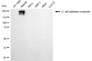 Western blotting analysis using L1 cell adhesion molecule antibody (ABIN7799218). (L1CAM 抗体)