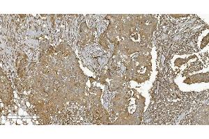 IHC analysis of PLTP using anti-PLTP antibody (ABIN7600346). (PLTP 抗体  (AA 18-470))