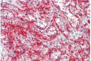 Immunohistochemistry (IHC) image for anti-Major Histocompatibility Complex, Class I, A (HLA-A) (AA 70-99) antibody (ABIN1902365)